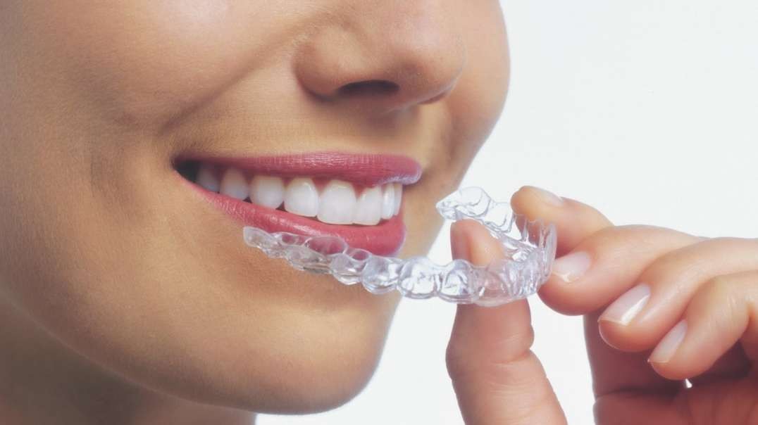 Call @ 786-565-3319 | Miami Dental Group | Invisalign in Doral, FL