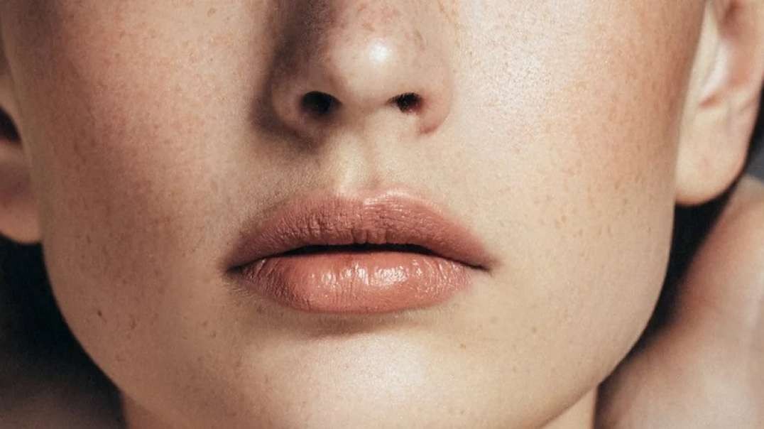 W Aesthetics : Dermal Fillers in Austin, TX