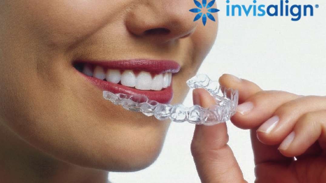 Invisalign Miami FL : Florida Dental Care of Miller