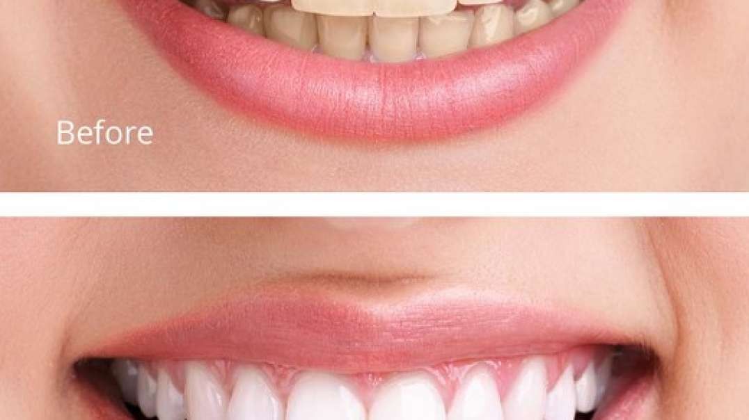 Axel Dental Studio : Teeth Whitening in Miami, FL