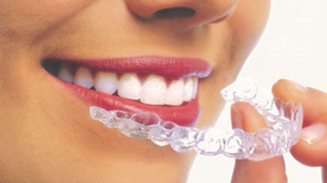 Mancia Orthodontics : Invisalign in Miami, FL | 305-559-5571