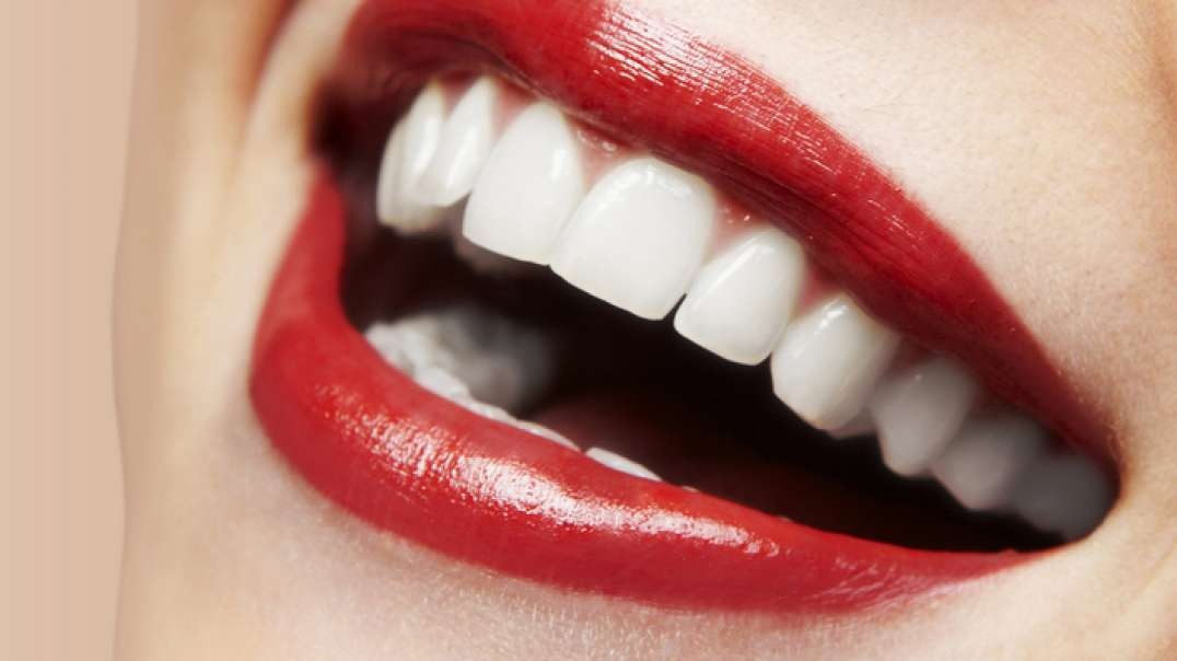 Rielo Dental Implants in Hialeah, FL | 33012